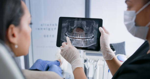 Licensed Tooth Extraction service in Mission Canyon, CA - Smile Center Dentistry
